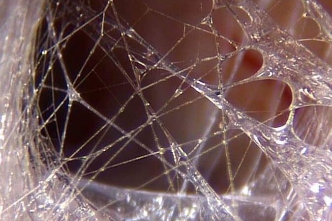 Microscopic photo of fascia