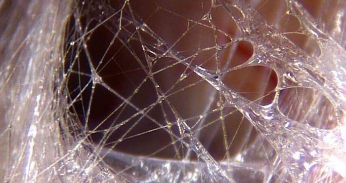 Photo of fascia Microscopic photo of fascia