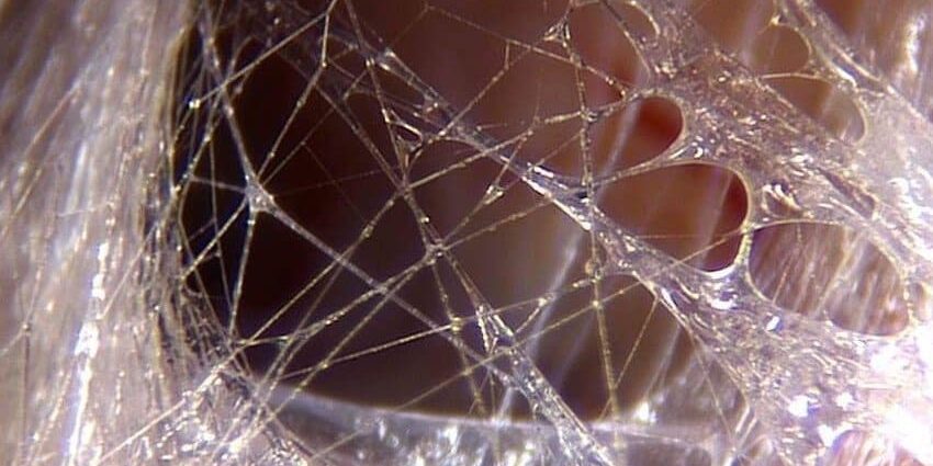 Microscopic photo of fascia