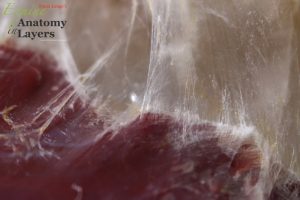 Photo of fascia being pulled away from muscle tissue.