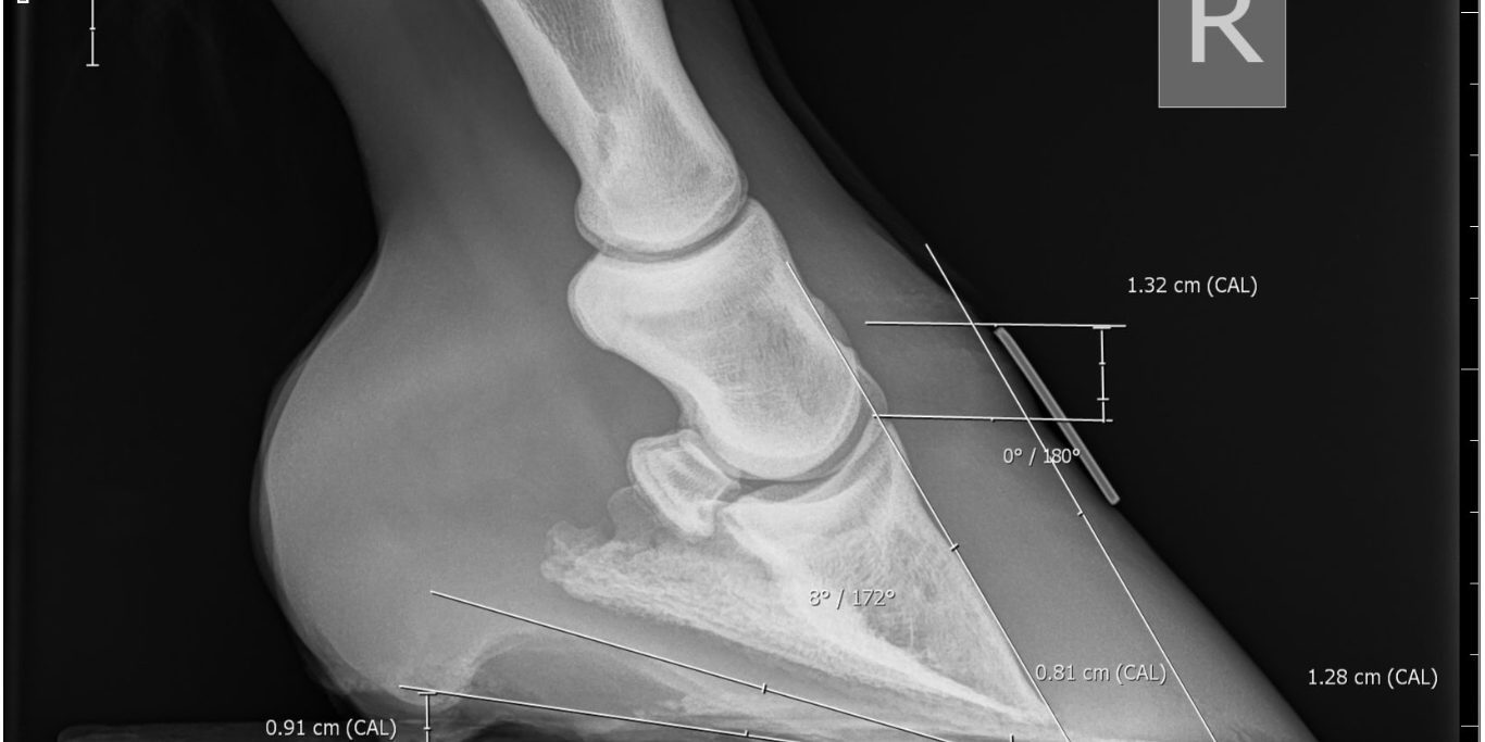 Photo of an X-ray of the right fore hoof showing 1.32cm of distal descent and 8º of rotation. You can also see that the sole is thin, as it is 0.91cm.