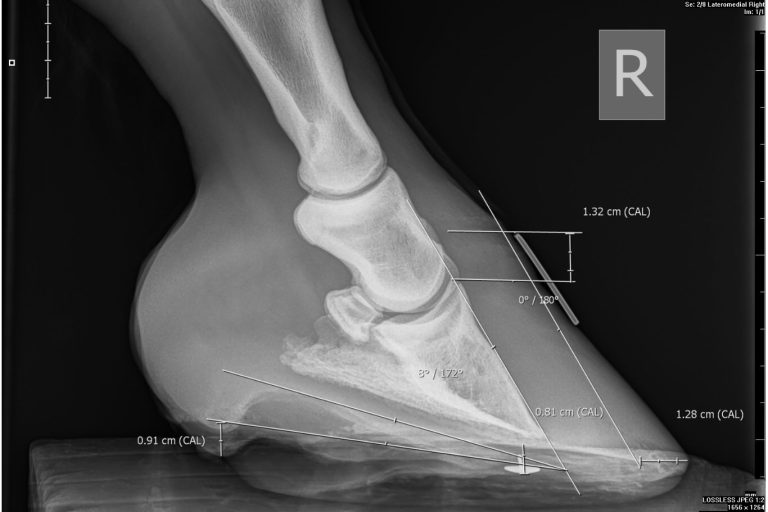 Photo of an X-ray of the right fore hoof showing 1.32cm of distal descent and 8º of rotation. You can also see that the sole is thin, as it is 0.91cm.